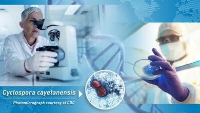 Ensalada en bolsa común contaminada con parásitos de ciclospora; causan malestar intestinal 13