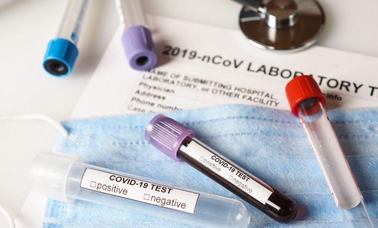 Nuevas admisiones al hospital continúan en aumento; Variante Delta del COVID-19 1