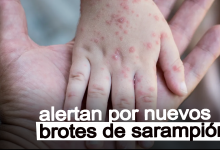 Autoridades de salud advierten posible exposición a sarampión en Aeropuerto Lambert de St. Louis 25