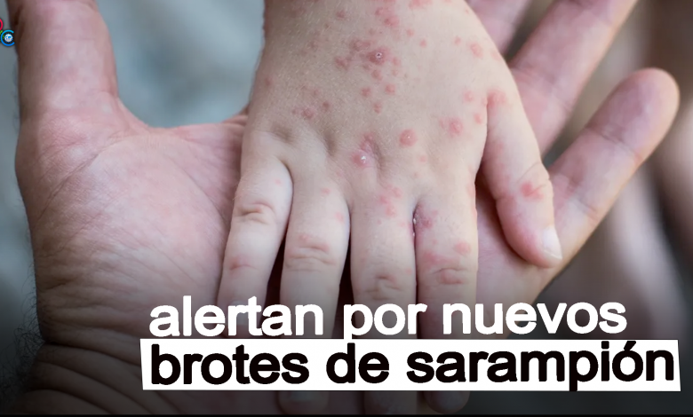 Autoridades de salud advierten posible exposición a sarampión en Aeropuerto Lambert de St. Louis 1